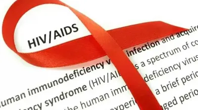 HIV AIDS